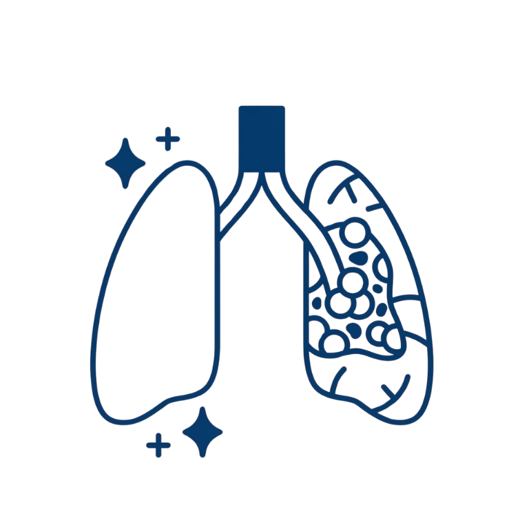 Lung Abscess treatment and management
